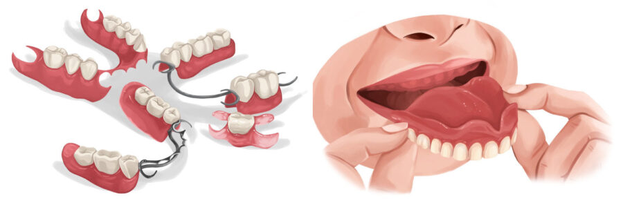 Illustration of partial dentures next to a woman taking out her full dentures