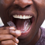 Photograph of Black man inserting Invisalign clear aligners, can boost self-esteem