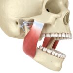botox for jaw pain
