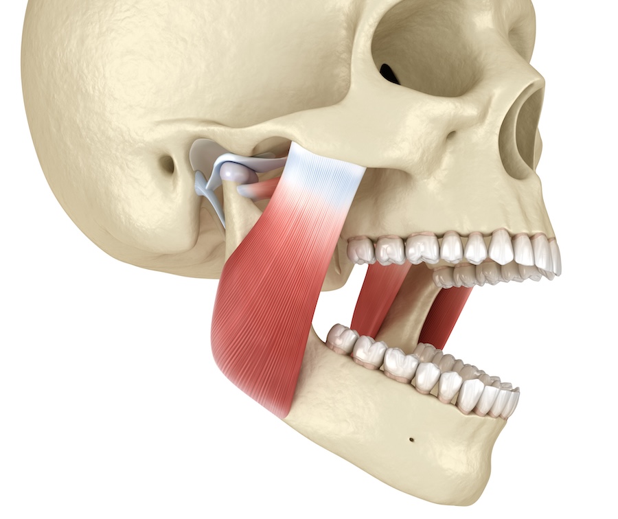 botox for jaw pain